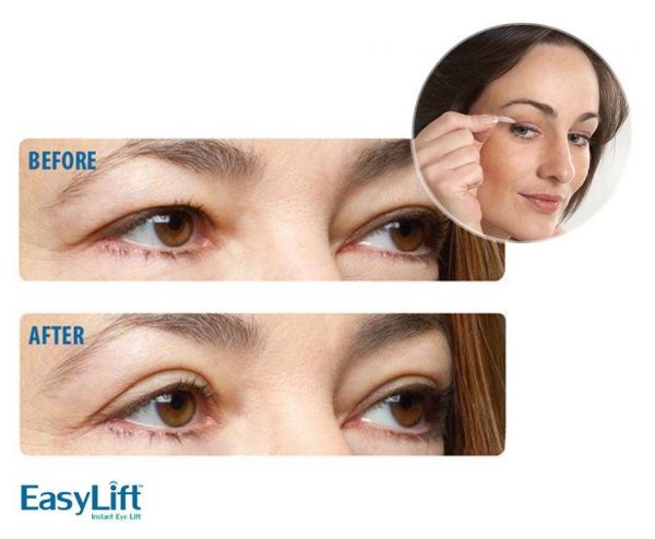 Easy Lift Ooglidstickers - Direct Een Jongere Oogopslag! ...