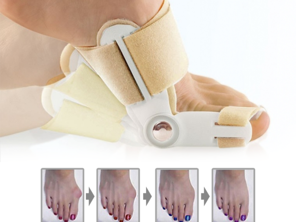 Hallux Valgus Teen Corrector - Verhelpt Pijn Bij Scheefstand Van De Grote T ...